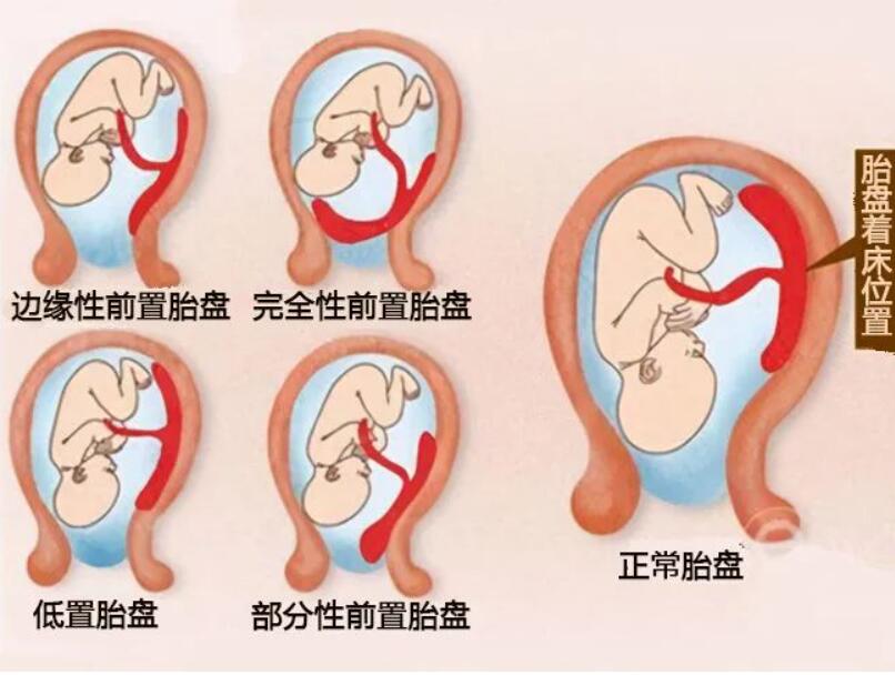 QQ截图20231122135712.jpg