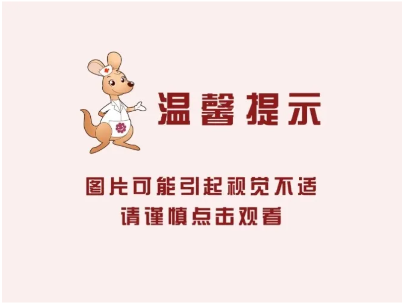 1725259922144199.png