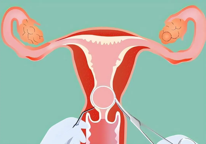 1763085861468105.png 1763085861468105.png